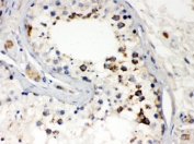 IHC testing of FFPE human testis with Smac antibody. HIER: Boil the paraffin sections in pH 6, 10mM citrate buffer for 20 minutes and allow to cool prior to staining.