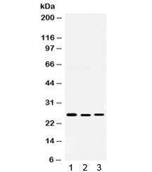 Western blot testing of 1) rat testis, 2) human 22RV1 and 3) human SKOV lysate with Smac antibody. Expected/observed molecular weight ~27 kDa.