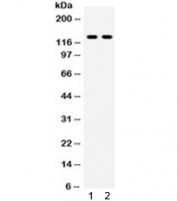 Western blot testing of 1) rat liver and 2) HepG2 lysate with TLR8 antibody. Expected/observed molecular weight ~120 kDa.