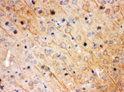 IHC testing of FFPE mouse brain with KChIP2 antibody. HIER: Boil the paraffin sections in pH 6, 10mM citrate buffer for 20 minutes and allow to cool prior to staining.