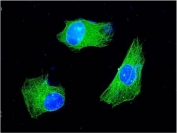 Immunofluorescent staining of FFPE human SH-SY5Y cells with KChIP2 antibody (green) and DAPI nuclear stain (blue). HIER: steam section in pH6 citrate buffer for 20 min.