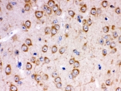 IHC testing of FFPE rat brain with KChIP2 antibody. HIER: Boil the paraffin sections in pH 6, 10mM citrate buffer for 20 minutes and allow to cool prior to staining.