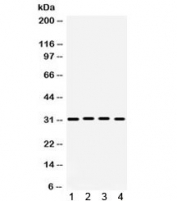 Western blot testing of 1) rat brain, 2) rat heart, 3) mouse heart and 4) human 22RV1 lysate with KChIP2 antibody. Expected molecular weight ~31 kDa.