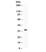 Western blot testing of human SMMC cell lysate with TREX1 antibody. Expected/observed molecular weight ~39/32/33 kDa (isoforms 1/2/3).