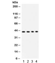 Western blot testing of 1) rat liver, 2) human HeLa, 3) SW620 and 4) mouse HEPA lysate with PARVA antibody. Predicted/observed molecular weight ~42 kDa.~