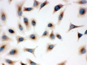 ICC testing of A549 cells with TLR7 antibody.