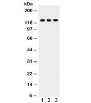 Western blot testing of 1) MCF7, 2) COLO320 and 3) Jurkat lysate with TLR7 antibody. Expected/observed molecular weight ~121 kDa.