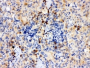 IHC testing of FFPE rat thymus with TLR7 antibody. HIER: Boil the paraffin sections in pH 6, 10mM citrate buffer for 20 minutes and allow to cool prior to staining.