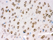 IHC testing of FFPE mouse brain with TRPM5 antibody. HIER: Boil the paraffin sections in pH 6, 10mM citrate buffer for 20 minutes and allow to cool prior to staining.