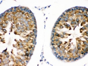 IHC testing of FFPE rat testis with TRPM5 antibody. HIER: Boil the paraffin sections in pH 6, 10mM citrate buffer for 20 minutes and allow to cool prior to staining.