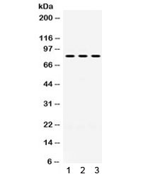 Western blot testing of 1) rat brain, 2) mouse brain, 3) U87 lysate with PAK5 antibody. Expected/observed molecular weight ~81 kDa.~