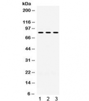 Western blot testing of 1) rat brain, 2) mouse brain, 3) U87 lysate with PAK5 antibody. Expected/observed molecular weight ~81 kDa.