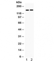 Western blot testing of 1) rat skeletal muscle and 2) human COLO320 lysate with HDAC6 antibody. Expected molecular weight 130~160 kDa, observed here at ~160 kDa.