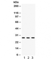 Western blot testing of 1) rat heart, 2) rat brain and 3) human A549 lysate with DKK2 antibody. Expected molecular weight: 28-35 kDa.