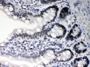 IHC testing of FFPE rat intestine with Daxx antibody. HIER: Boil the paraffin sections in pH 6, 10mM citrate buffer for 20 minutes and allow to cool prior to staining.