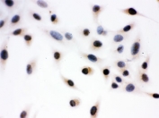 ICC testing of human A549 cells with Daxx antibody.