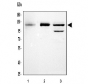 Western blot testing of 1) human K562, 2) rat PC-12 and 3) mouse thymus lysate with Daxx antibody. Predicted molecular weight ~81 kDa but routinely observed at ~120 kDa, the slow SDS-PAGE migration possibly due to the proteins high acidic residue content.