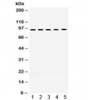 Western blot testing of human 1) A549, 2) SW620, 3) HeLa, 4) PANC, and 5) HepG2 lysate with MCM8 antibody. Expected/observed molecular weight ~94/89 kDa (isoforms 1/2).