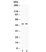 Western blot testing of human 1) HeLa and 2) A549 cell lysate with ING1 antibody. Expected/observed molecular weight ~47 kDa.