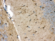 IHC testing of FFPE rat brain with NDRG2 antibody. HIER: Boil the paraffin sections in pH 6, 10mM citrate buffer for 20 minutes and allow to cool prior to staining.