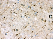 IHC testing of FFPE mouse brain with NDRG2 antibody. HIER: Boil the paraffin sections in pH 6, 10mM citrate buffer for 20 minutes and allow to cool prior to staining.
