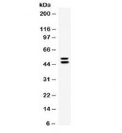Western blot testing of human A549 cell lysate with EPCR antibody. Expected molecular weight ~24/36-46 kDa (unmodified/glycosylated). The ~52 kDa band may represent a further modification of the protein.