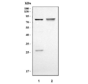 Western blot testing of 1) human A549 and 2) human placenta tissue lysate with ABCG2 antibody. Predicted molecular weight ~72 kDa and ~67 kDa (two isoforms).