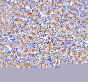 IHC staining of FFPE rat kidney tissue with ABCG2 antibody, HRP-secondary and DAB substrate. HIER: boil tissue sections in pH8 EDTA for 20 min and allow to cool before testing.