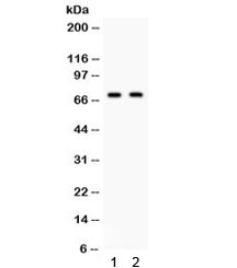 Western blot testing of human 1) 22RV1 and 2) 293 cell lysate with FZD1 antibody. Predicted/observed molecular weight ~71 kDa.~