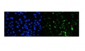 Immunofluorescent staining of FFPE human A431 cells with TIF1 antibody (green) and DAPI nuclear stain (blue). HIER: steam section in pH6 citrate buffer for 20 min.