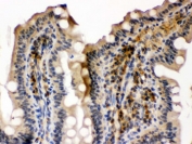 IHC testing of FFPE mouse intestine with SMC3 antibody. HIER: Boil the paraffin sections in pH 6, 10mM citrate buffer for 20 minutes and allow to cool prior to staining.