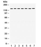 Western blot testing of 1) rat brain, 2) rat liver, 3) rat testis, 4) human HeLa, 5) human A549, 6) human MCF7 and 7) mouse NIH3T3 lysate with SMC3 antibody. Exepcted/observed molecular weight ~141 kDa.