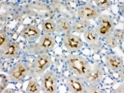 IHC testing of FFPE rat kidney with SMC3 antibody. HIER: Boil the paraffin sections in pH 6, 10mM citrate buffer for 20 minutes and allow to cool prior to staining.