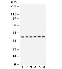 Western blot test of 1) rat brain, 2) human HepG2, 3) SMMC, 4) U87, 5) human placenta, 6) HeLa lysate with STRAP antibody. Predicted/observed molecular weight ~38 kDa.~
