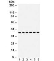 Western blot test of 1) rat brain, 2) human HepG2, 3) (h) SMMC, 4) (h) U87, 5) (h) placenta, 6) (h) HeLa lysate with STRAP antibody. Predicted/observed molecular weight ~38 kDa.