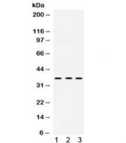 Western blot testing of human 1) Jurkat, 2) PANC and 3) K562 cell lysate with PRKAB1 antibody. Expected molecular weight ~30 kDa, observed here at ~38 kDa.