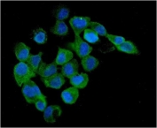 Immunofluorescent staining of FFPE human A431 cells with PRKAB1 antibody (green) and DAPI nuclear stain (blue). HIER: steam section in pH6 citrate buffer for 20 min.