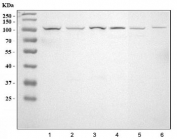 Western blot testing of 1) human HeLa, 2) human MCF7, 3) human MDA-MB-453, 4) rat brain, 5) mouse brain and 6) mouse lung lysate with LOXL2 antibody. Predicted molecular weight ~87 kDa, commonly observed at 87-105 kDa.