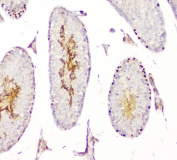 IHC testing of FFPE mouse testis with DMRT1 antibody. HIER: Boil the paraffin sections in pH 6, 10mM citrate buffer for 20 minutes and allow to cool prior to staining.