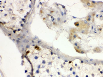 IHC testing of FFPE human testis with DMRT1 antibody. HIER: Boil the paraffin sections in pH 6, 10mM citrate buffer for 20 minutes and allow to cool prior to staining.