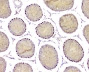 IHC testing of FFPE rat testis with DMRT1 antibody. HIER: Boil the paraffin sections in pH 6, 10mM citrate buffer for 20 minutes and allow to cool prior to staining.