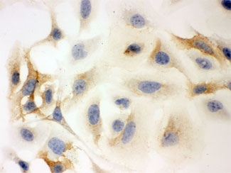 ICC testing of FFPE human HeLa cells with HLA-C antibody. HIER: Boil the paraffin sections in pH 6, 10mM citrate buffer for 20 minutes and allow to cool prior to staining.