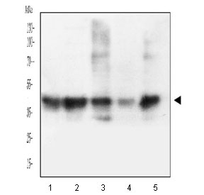 Western blot testing of human 1) U937, 2) Jurkat, 3) HeLa, 4) A549 and 5) U-87 MG cell lysate with HLA-C antibody. Expected molecular weight ~41 kDa.
