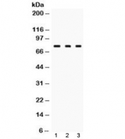 Western blot testing of TGM2 antibody and Lane 1:  rat liver, 2. rat ovary and 3: HeLa lysate.  Predicted/observed molecular weight: ~ 78 kDa.
