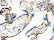 IHC-F: TGM2 antibody testing of human placental tissue