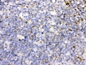 IHC testing of FFPE human tonsil with CD27 antibody. HIER: Boil the paraffin sections in pH 6, 10mM citrate buffer for 20 minutes and allow to cool prior to testing.