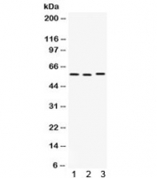 Western blot testing of 1) rat thymus, 2) rat spleen, and 3) human SMMC-7721 lysate with CAP1 antibody. Predicted molecular weight ~52 kDa, but routinely observed at 55-60 kDa.
