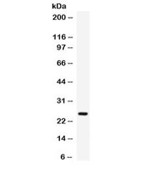 Western blot testing of human placenta lysate with Elafin antibody. Predicted molecular weight ~12 kDa (pre-form), observed here at ~25 kDa.~