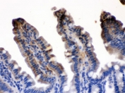 IHC testing of FFPE mouse intestine with FABP2 antibody. HIER: Boil the paraffin sections in pH 6, 10mM citrate buffer for 20 minutes and allow to cool prior to testing.