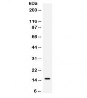 Western blot testing of human SW620 cell lysate with FABP2 antibody. Expected/observed molecular weight ~15 kDa.